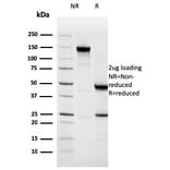 SDS-PAGE - Anti-NAPSIN A Antibody [NAPSA/3308] (A250665) - Antibodies.com