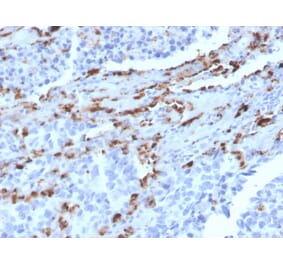 Immunohistochemistry - Anti-NAPSIN A Antibody [NAPSA/3309] (A250666) - Antibodies.com