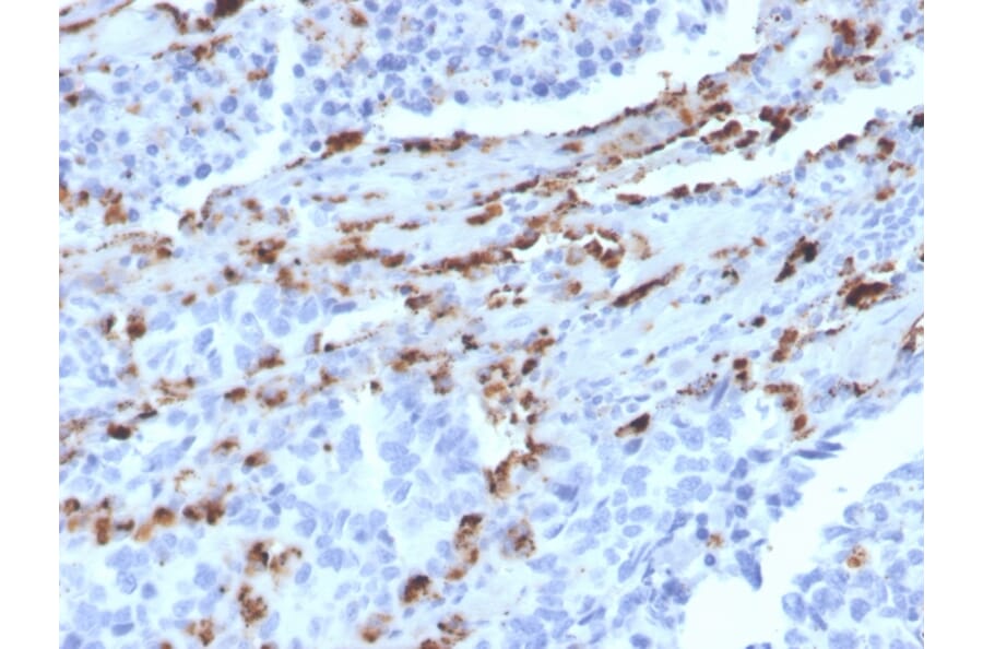 Immunohistochemistry - Anti-NAPSIN A Antibody [NAPSA/3309] (A250666) - Antibodies.com