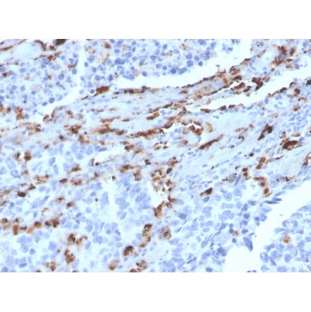 Immunohistochemistry - Anti-NAPSIN A Antibody [NAPSA/3309] (A250666) - Antibodies.com