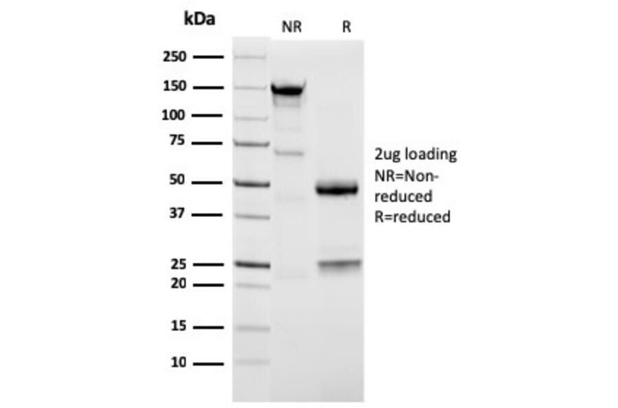 SDS-PAGE - Anti-NAPSIN A Antibody [NAPSA/3309] (A250666) - Antibodies.com