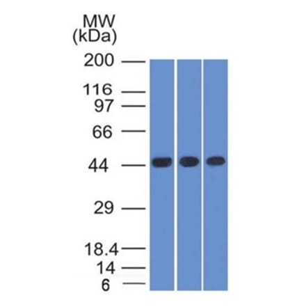 Western Blot - Anti-NAPSIN A Antibody [NAPSA/1238] (A250667) - Antibodies.com