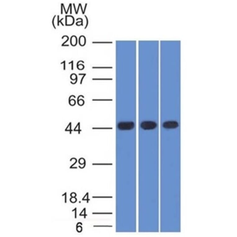 Western Blot - Anti-NAPSIN A Antibody [NAPSA/1238] (A250667) - Antibodies.com