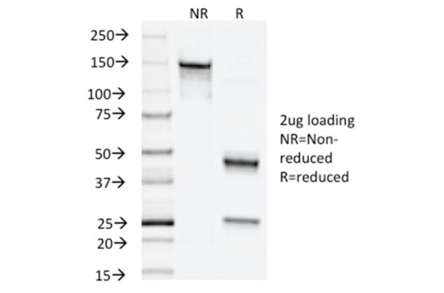 SDS-PAGE - Anti-NAPSIN A Antibody [NAPSA/1238] (A250667) - Antibodies.com