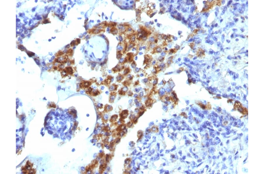 Immunohistochemistry - Anti-NAPSIN A Antibody [NAPSA/1239] (A250667) - Antibodies.com