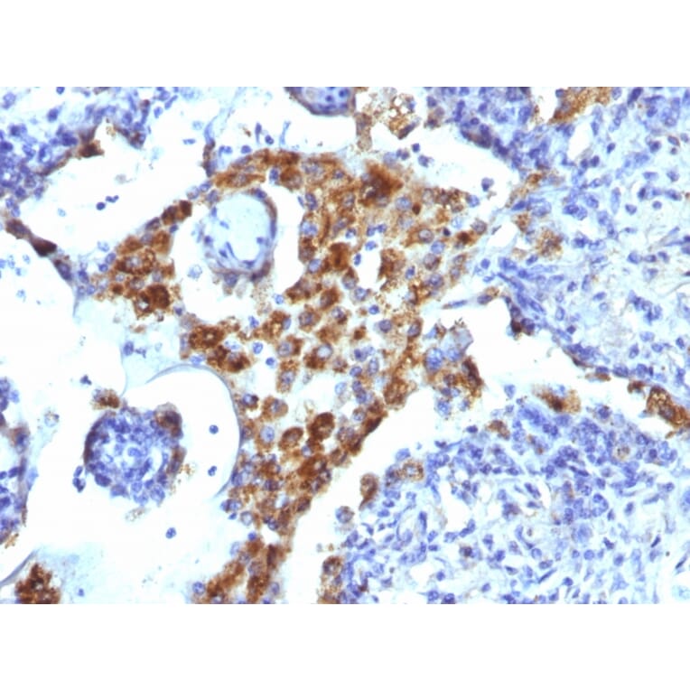 Immunohistochemistry - Anti-NAPSIN A Antibody [NAPSA/1239] (A250667) - Antibodies.com