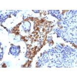 Immunohistochemistry - Anti-NAPSIN A Antibody [NAPSA/1239] (A250667) - Antibodies.com