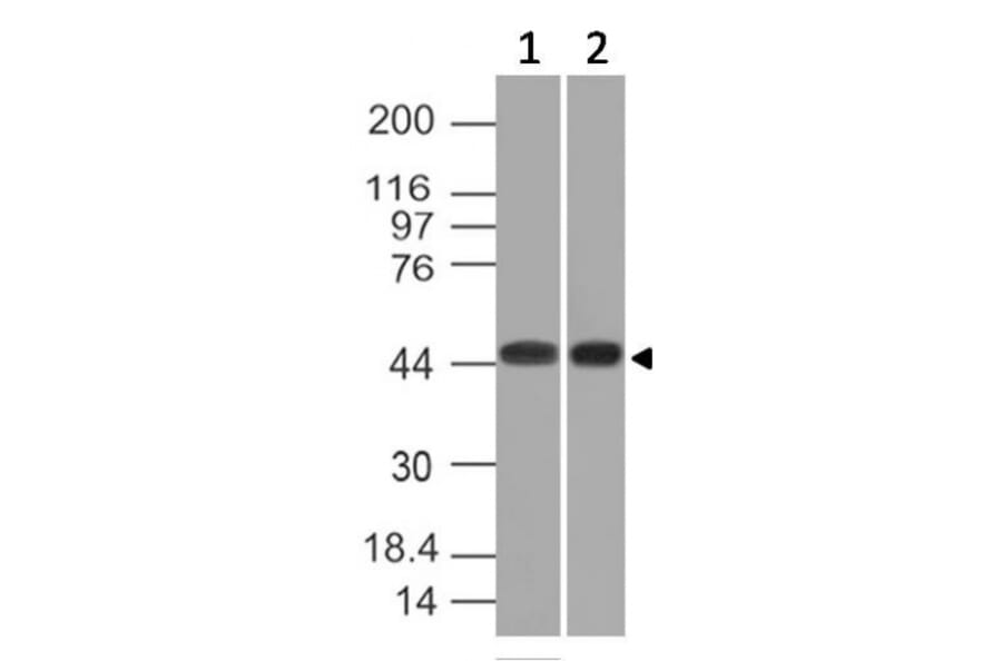 Western Blot - Anti-NAPSIN A Antibody [NAPSA/1239] (A250668) - Antibodies.com