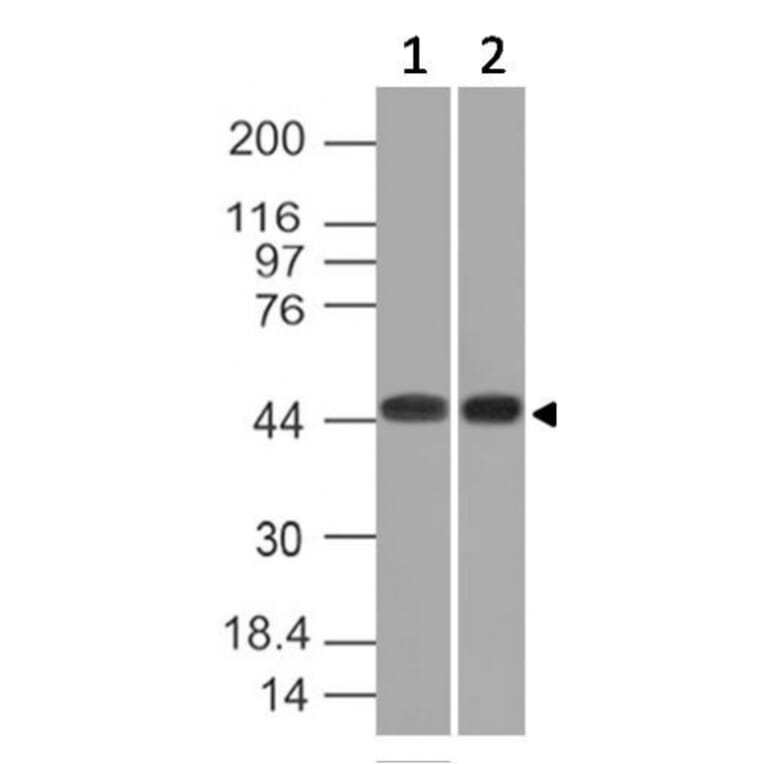 Western Blot - Anti-NAPSIN A Antibody [NAPSA/1239] (A250668) - Antibodies.com