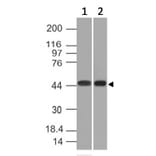 Western Blot - Anti-NAPSIN A Antibody [NAPSA/1239] (A250668) - Antibodies.com