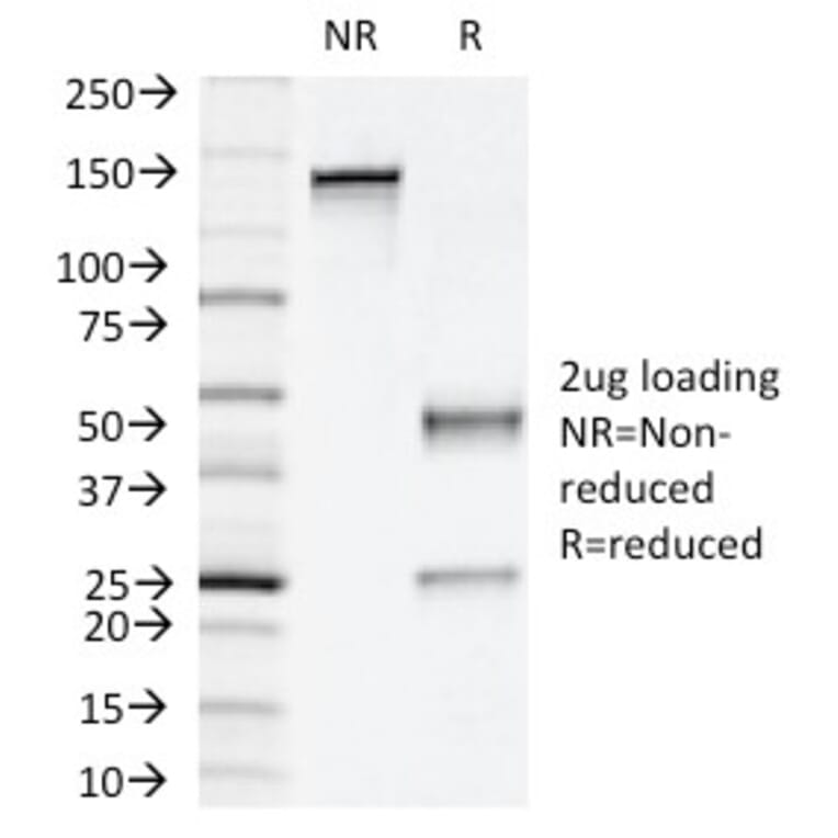 SDS-PAGE - Anti-NAPSIN A Antibody [NAPSA/1239] (A250668) - Antibodies.com