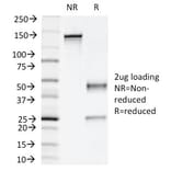 SDS-PAGE - Anti-NAPSIN A Antibody [NAPSA/1239] (A250668) - Antibodies.com