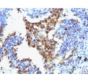 Immunohistochemistry - Anti-NAPSIN A Antibody [NAPSA/1238 + NAPSA/1239] (A250668) - Antibodies.com
