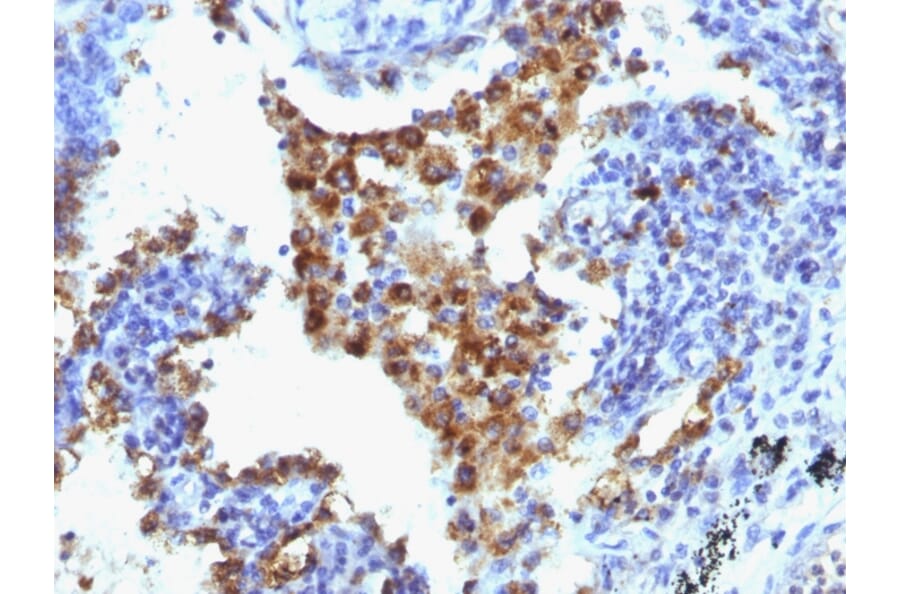 Immunohistochemistry - Anti-NAPSIN A Antibody [NAPSA/1238 + NAPSA/1239] (A250668) - Antibodies.com