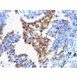 Immunohistochemistry - Anti-NAPSIN A Antibody [NAPSA/1238 + NAPSA/1239] (A250668) - Antibodies.com