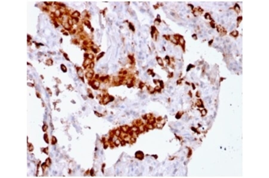 Immunohistochemistry - Anti-NAPSIN A Antibody [rNAPSA/1239] (A250669) - Antibodies.com