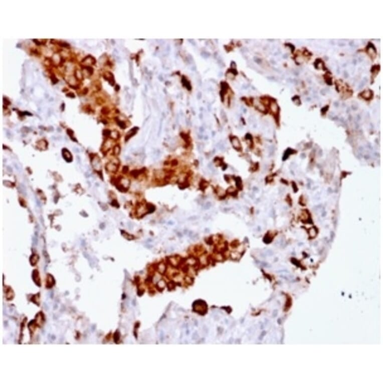 Immunohistochemistry - Anti-NAPSIN A Antibody [rNAPSA/1239] (A250669) - Antibodies.com