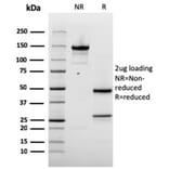 SDS-PAGE - Anti-NAPSIN A Antibody [rNAPSA/1239] (A250670) - Antibodies.com
