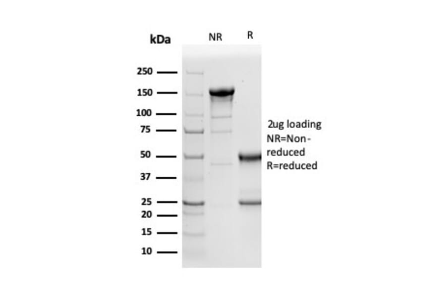 SDS-PAGE - Anti-NAPSIN A Antibody [NAPSA/3305] (A250671) - Antibodies.com