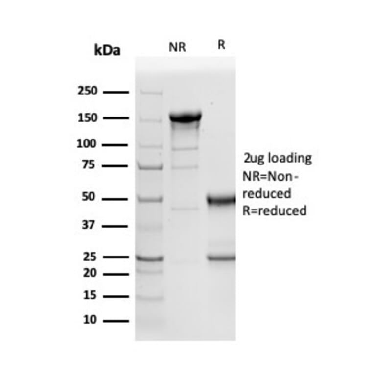 SDS-PAGE - Anti-NAPSIN A Antibody [NAPSA/3305] (A250671) - Antibodies.com