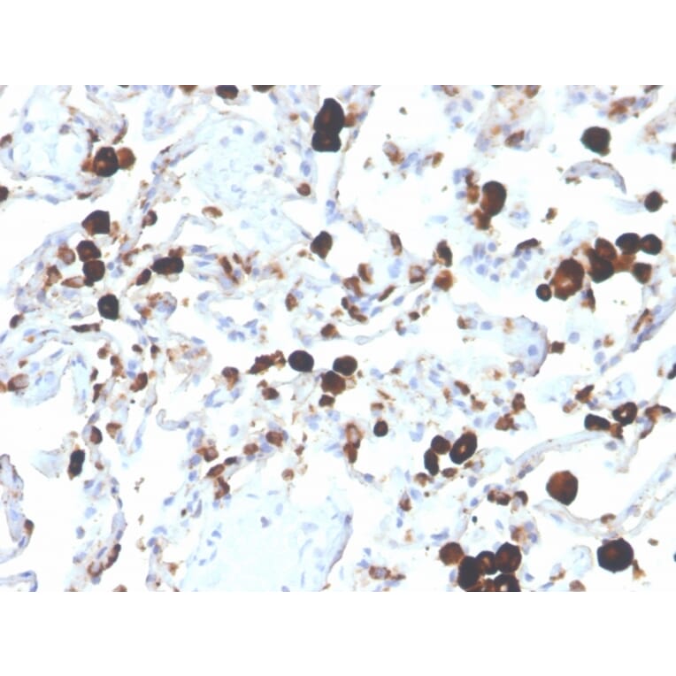 Immunohistochemistry - Anti-NAPSIN A Antibody [NAPSA/3305] (A250671) - Antibodies.com
