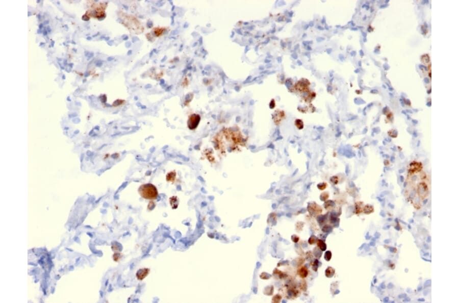 Immunohistochemistry - Anti-NAPSIN A Antibody [NAPSA/3306] (A250672) - Antibodies.com