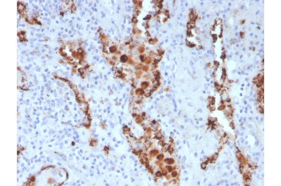 Immunohistochemistry - Anti-NAPSIN A Antibody [NAPSA/3307] (A250673) - Antibodies.com