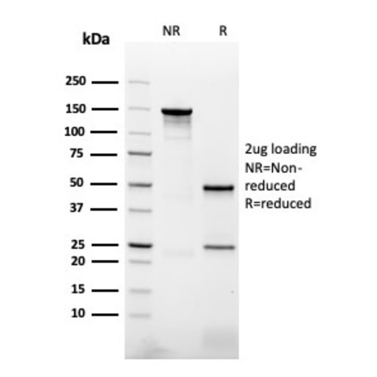 SDS-PAGE - Anti-NAPSIN A Antibody [NAPSA/3307] (A250673) - Antibodies.com