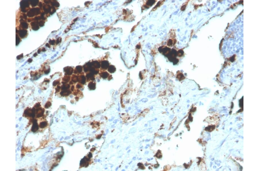 Immunohistochemistry - Anti-NAPSIN A Antibody [NAPSA/4400R] (A250674) - Antibodies.com