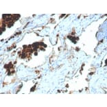 Immunohistochemistry - Anti-NAPSIN A Antibody [NAPSA/4400R] (A250674) - Antibodies.com