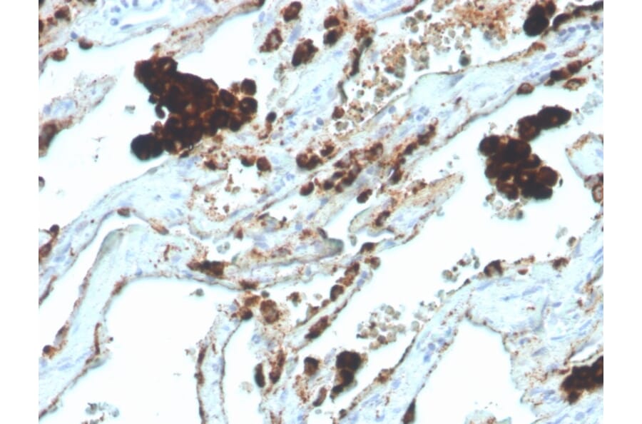 Immunohistochemistry - Anti-NAPSIN A Antibody [NAPSA/4400R] (A250674) - Antibodies.com