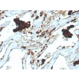 Immunohistochemistry - Anti-NAPSIN A Antibody [NAPSA/4400R] (A250674) - Antibodies.com