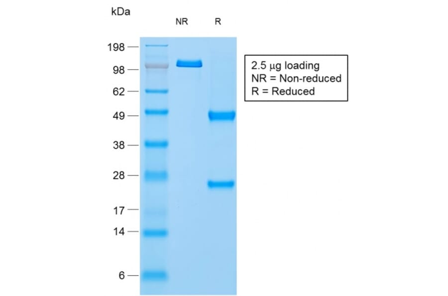 SDS-PAGE - Anti-NAPSIN A Antibody [NAPSA/1865R] (A250675) - Antibodies.com