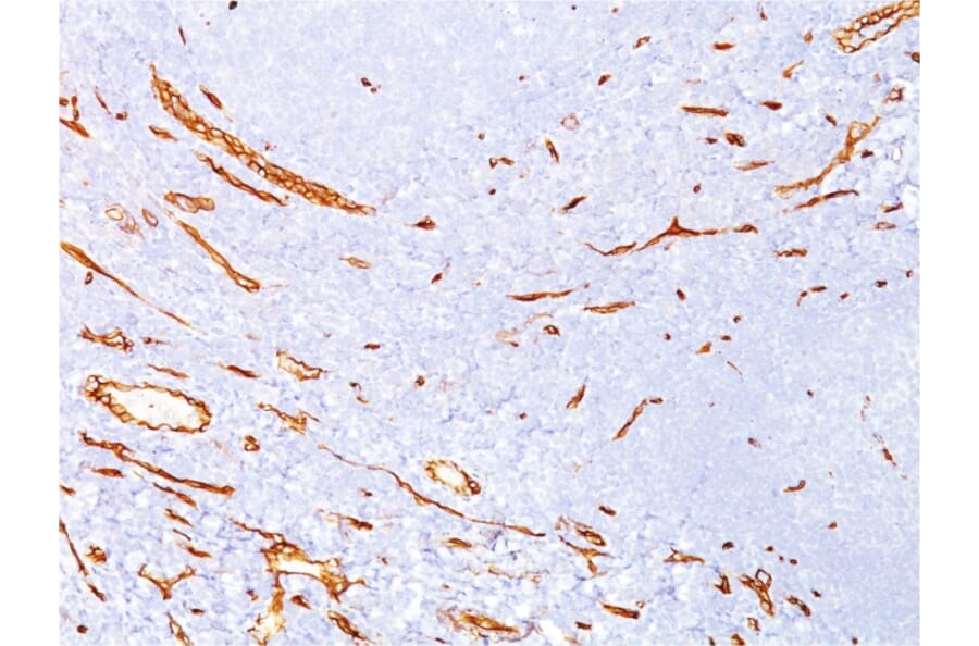 Immunohistochemistry - Anti-CD34 Antibody [QBEnd/10] (A250677) - Antibodies.com