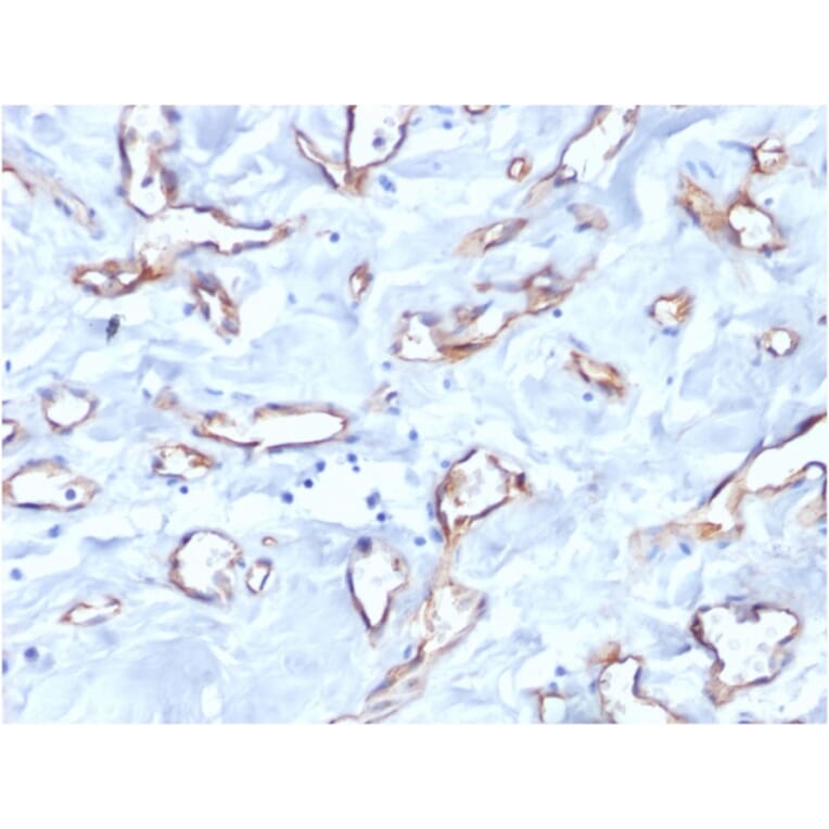 Immunohistochemistry - Anti-CD34 Antibody [QBEnd/10] (A250677) - Antibodies.com