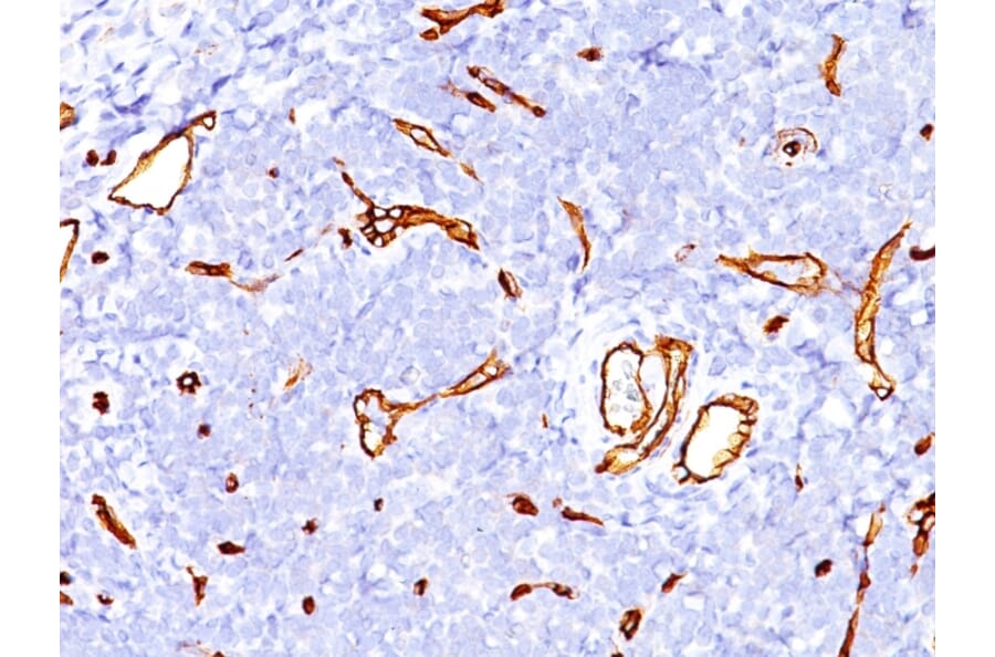 Immunohistochemistry - Anti-CD34 Antibody [SPM123] (A250677) - Antibodies.com