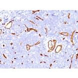 Immunohistochemistry - Anti-CD34 Antibody [SPM123] (A250677) - Antibodies.com