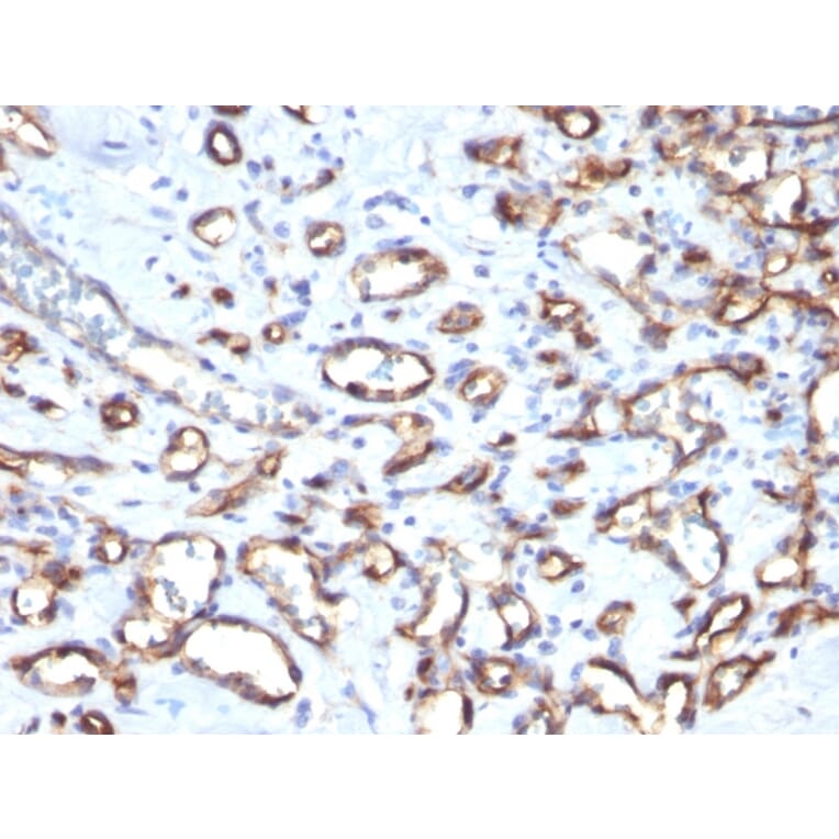Immunohistochemistry - Anti-CD34 Antibody [SPM610] (A250681) - Antibodies.com