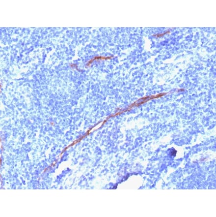 Immunohistochemistry - Anti-CD34 Antibody [HPCA1/1806R] (A250683) - Antibodies.com