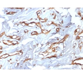 Immunohistochemistry - Anti-CD34 Antibody [HPCA1/2598R] (A250684) - Antibodies.com