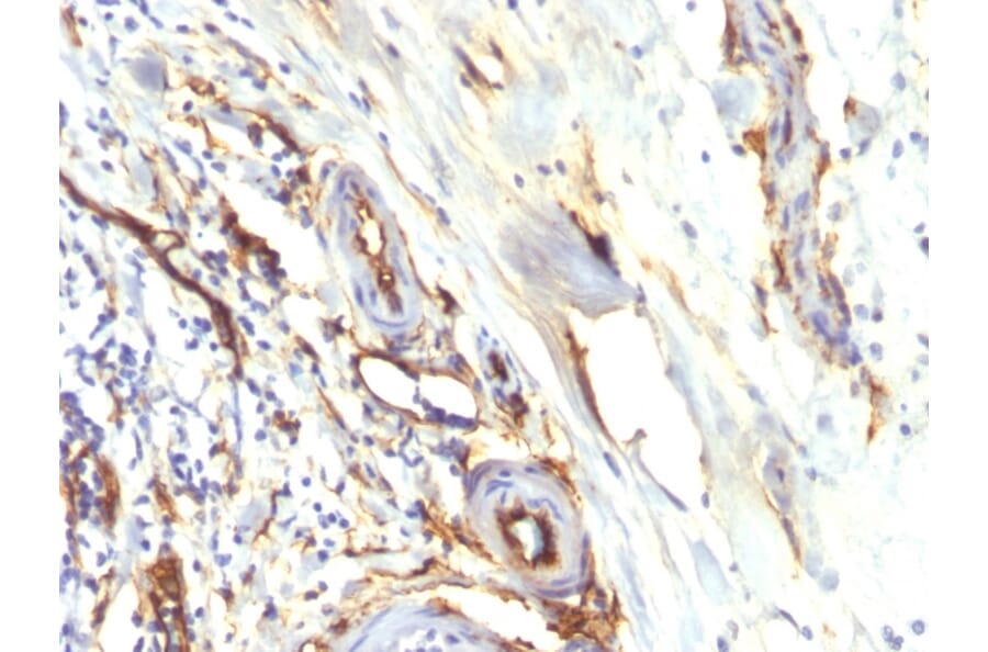 Immunohistochemistry - Anti-CD34 Antibody [HPCA1/2598R] (A250684) - Antibodies.com