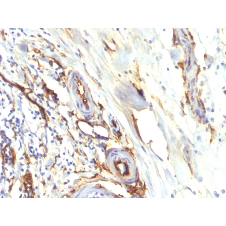 Immunohistochemistry - Anti-CD34 Antibody [HPCA1/2598R] (A250684) - Antibodies.com