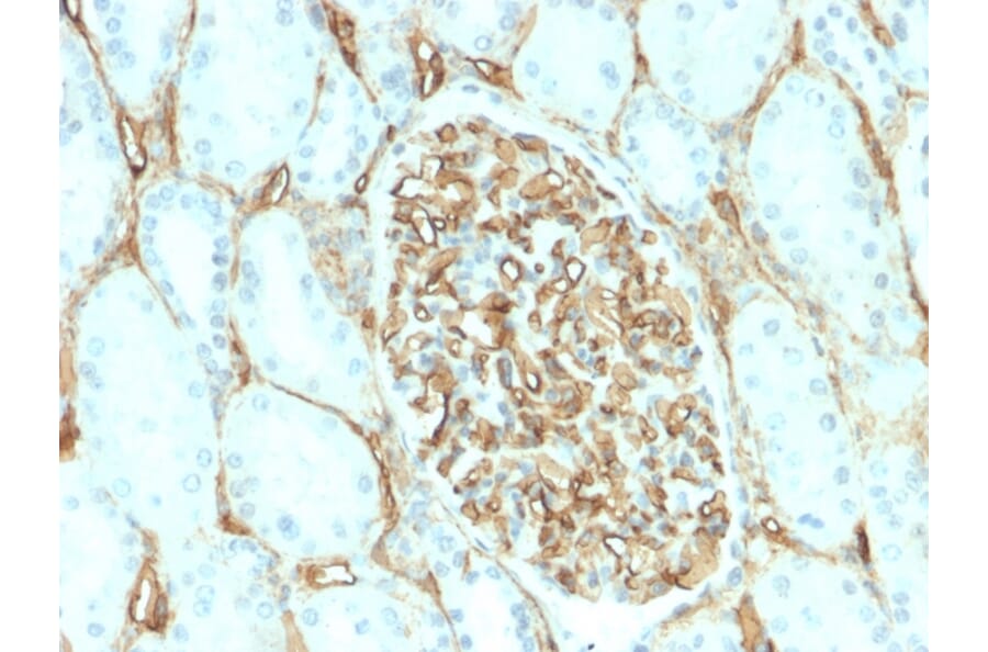 Immunohistochemistry - Anti-CD34 Antibody [HPCA1/2598R] (A250684) - Antibodies.com