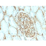 Immunohistochemistry - Anti-CD34 Antibody [HPCA1/2598R] (A250684) - Antibodies.com
