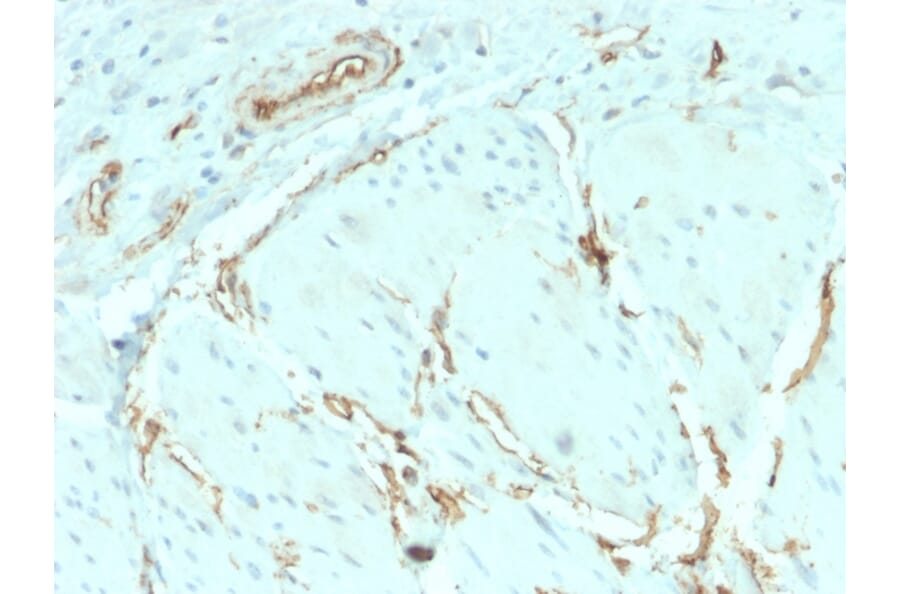 Immunohistochemistry - Anti-CD34 Antibody [HPCA1/2598R] (A250684) - Antibodies.com