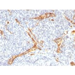 Immunohistochemistry - Anti-CD34 Antibody [HPCA1/2598R] (A250684) - Antibodies.com