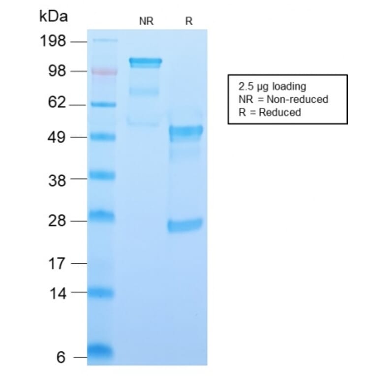 SDS-PAGE - Anti-CD34 Antibody [HPCA1/2598R] (A250684) - Antibodies.com