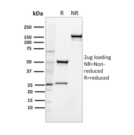 SDS-PAGE - Anti-CD36 Antibody [185-1G2] (A250685) - Antibodies.com