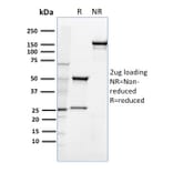 SDS-PAGE - Anti-CD36 Antibody [185-1G2] (A250685) - Antibodies.com