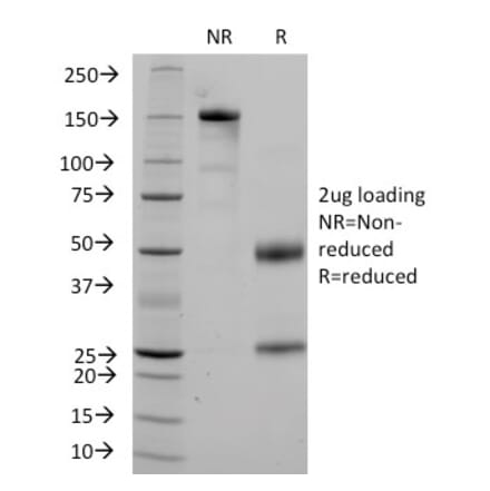 SDS-PAGE - Anti-CD36 Antibody [1A7] (A250686) - Antibodies.com
